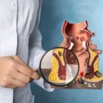 consulta-proctologia